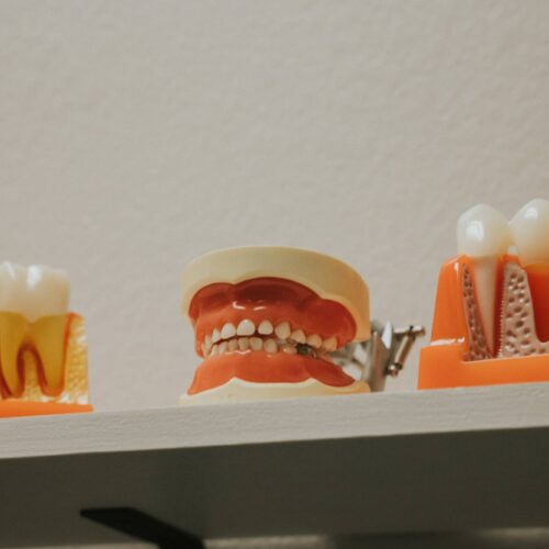 Santha Martha Teeth Model Santha Martha Teeth Model